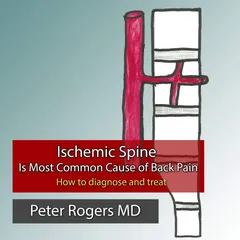 Cover of Ischemic Spine Is Most Common Cause of Back Pain